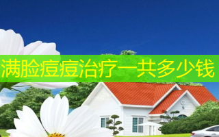 满脸痘痘治疗一共多少钱