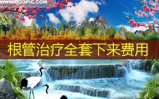 根管治疗全套下来费用