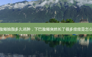 下巴脸颊抽脂多久消肿，下巴脸颊突然长了很多痘痘是怎么回事
