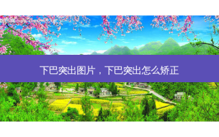 下巴突出图片，下巴突出怎么矫正