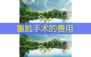 重睑手术的费用