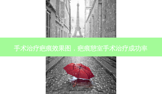 手术治疗疤痕效果图,疤痕憩室手术治疗成功率-第1张图片-美美网 手术治疗疤痕效果图,疤痕憩室手术治疗成功率-第1张图片-美美网