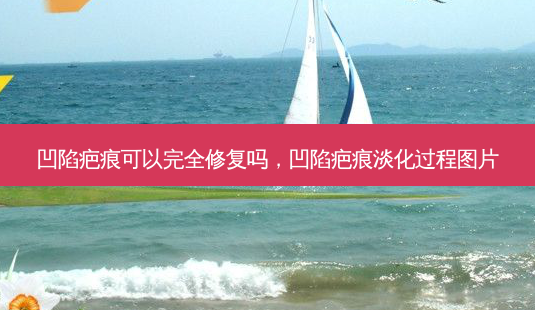 凹陷疤痕可以完全修复吗,凹陷疤痕淡化过程图片-第1张图片-美美网 凹陷疤痕可以完全修复吗,凹陷疤痕淡化过程图片-第1张图片-美美网