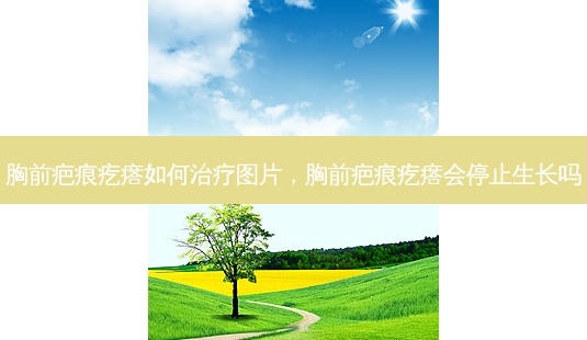 胸前疤痕疙瘩如何治疗图片,胸前疤痕疙瘩会停止生长吗-第1张图片-美美网 胸前疤痕疙瘩如何治疗图片,胸前疤痕疙瘩会停止生长吗-第1张图片-美美网