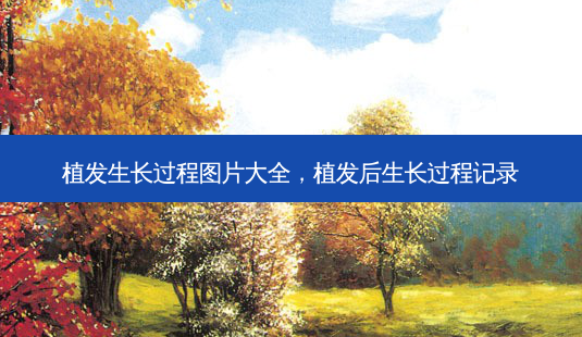 植发生长过程图片大全,植发后生长过程记录-第1张图片-美美网 植发生长过程图片大全,植发后生长过程记录-第1张图片-美美网