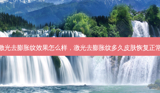 激光去膨胀纹效果怎么样,激光去膨胀纹多久皮肤恢复正常-第1张图片-美美网 激光去膨胀纹效果怎么样,激光去膨胀纹多久皮肤恢复正常-第1张图片-美美网