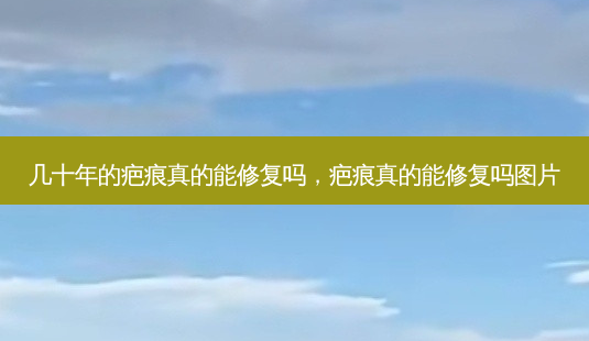 几十年的疤痕真的能修复吗,疤痕真的能修复吗图片-第1张图片-美美网 几十年的疤痕真的能修复吗,疤痕真的能修复吗图片-第1张图片-美美网