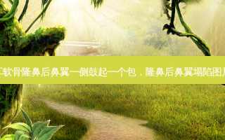 耳软骨隆鼻后鼻翼一侧鼓起一个包，隆鼻后鼻翼塌陷图片
