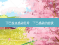下巴发炎感染图片，下巴感染的症状