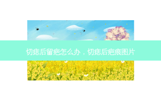 切痣后留疤怎么办，切痣后疤痕图片
