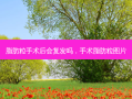 脂肪粒手术后会复发吗，手术脂肪粒图片