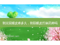 割完双眼皮疼多久，割双眼皮打麻药疼吗