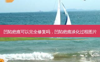凹陷疤痕可以完全修复吗，凹陷疤痕淡化过程图片