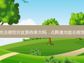 激光去痘坑对皮肤伤害大吗，点阵激光能去痘坑吗
