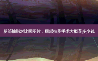 腿部抽脂对比照图片，腿部抽脂手术大概花多少钱