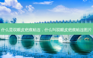 什么是双眼皮疤痕粘连，什么叫双眼皮疤痕粘连图片
