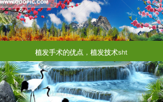 植发手术的优点，植发技术sht