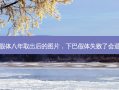 下巴假体八年取出后的图片，下巴假体失败了会退钱吗